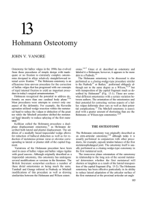 13 Hohmann Osteotomy JOHN V. VANORE