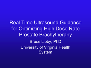 Real Time Ultrasound Guidance for Optimizing High Dose Rate Prostate Brachytherapy