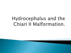 Hydrocephalus and Arnold chiari malformation