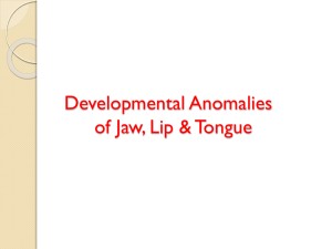 developmental anamolies jaw n lip