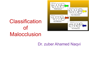 Classification of Malocclusion Dr. zuber Ahamed Naqvi