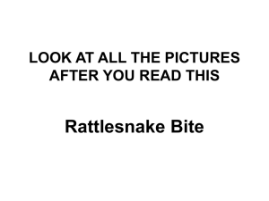 Rattlesnake Bite LOOK AT ALL THE PICTURES AFTER YOU READ THIS