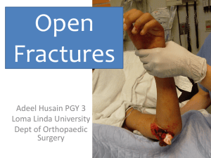 Open Fractures