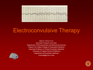 Electroconvulsive Therapy