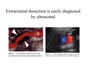 Extracranial dissection is easily diagnosed by ultrasound