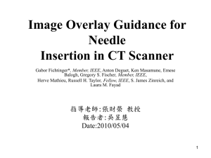 Image Overlay Guidance for Needle Insertion in CT Scanner 指導老師:張財榮 教授