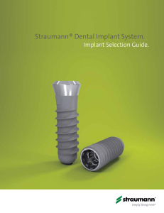 SDIS Implant Selection Guide