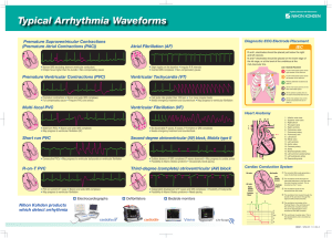 Typical Arrhythmia Waveforms