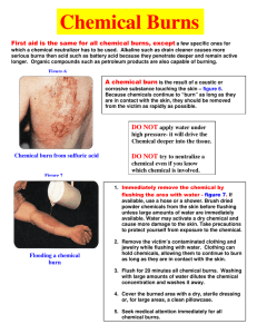 Chemical Burns - TigerSafety.us