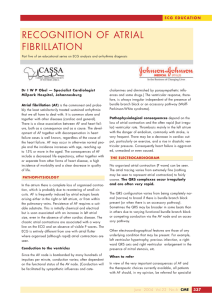 recognition of atrial fibrillation