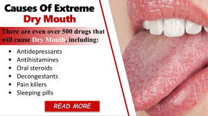 Home Remedies for Dry Mouth Relief