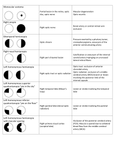 Visual field defects