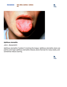 Aphthous stomatitis