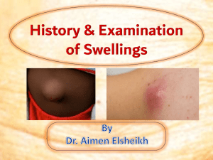 History and Examination of swellings Sep 2023