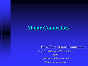 06-  Maxillary Major Connectors-1