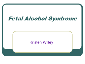 Fetal Alcohol Syndrome - Weber State University