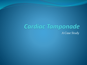 Cardiac Tamponade PP
