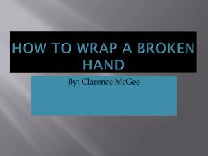 Clarence McGee How to wrap a broken hand - King-C