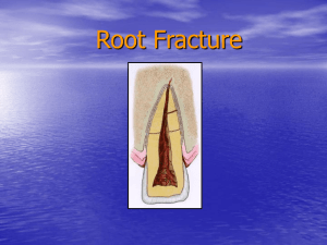 Root Fracture