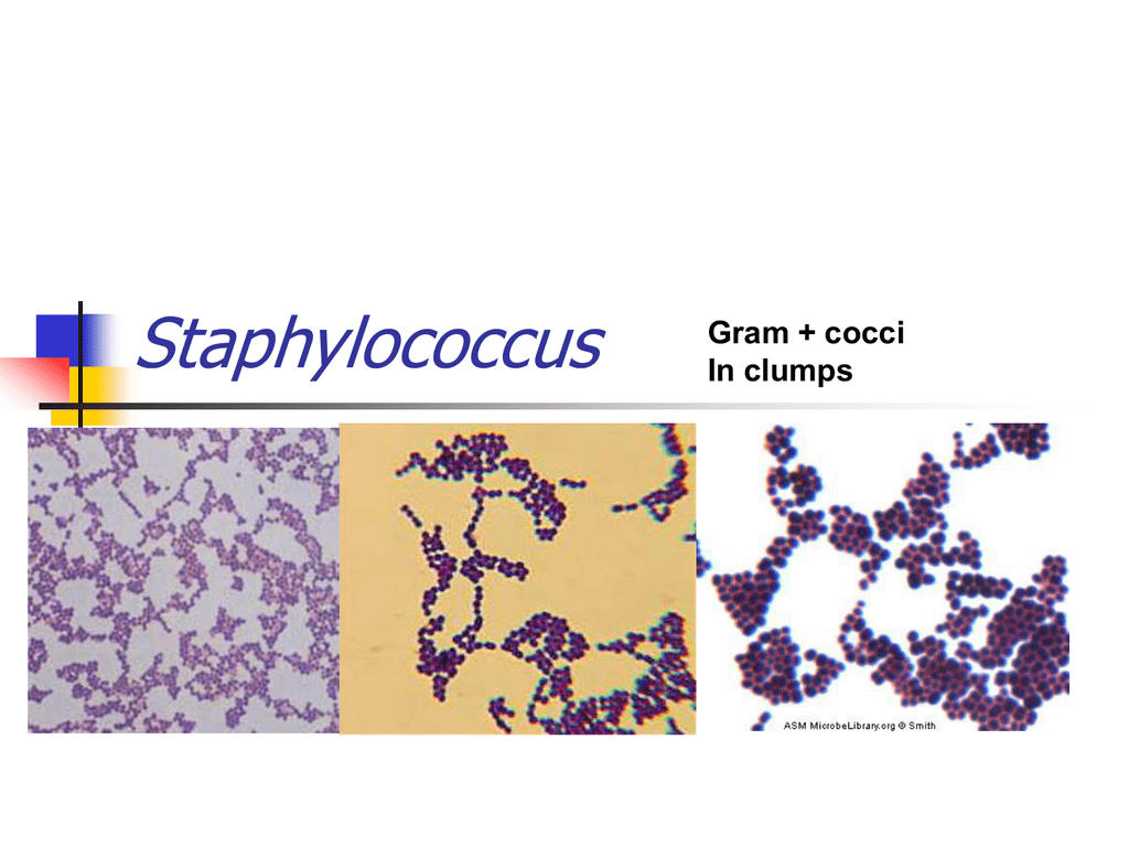 Staphylococcus aureus 4. Стафилококк сапрофитикус. Стрептококк сапрофитикус. Стафилококки деление. Стафилококк картинки для презентации.