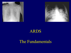 ARDS: The Fundamentals