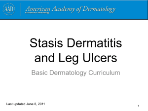 Stasis dermatitis and leg ulcers - American Academy of Dermatology