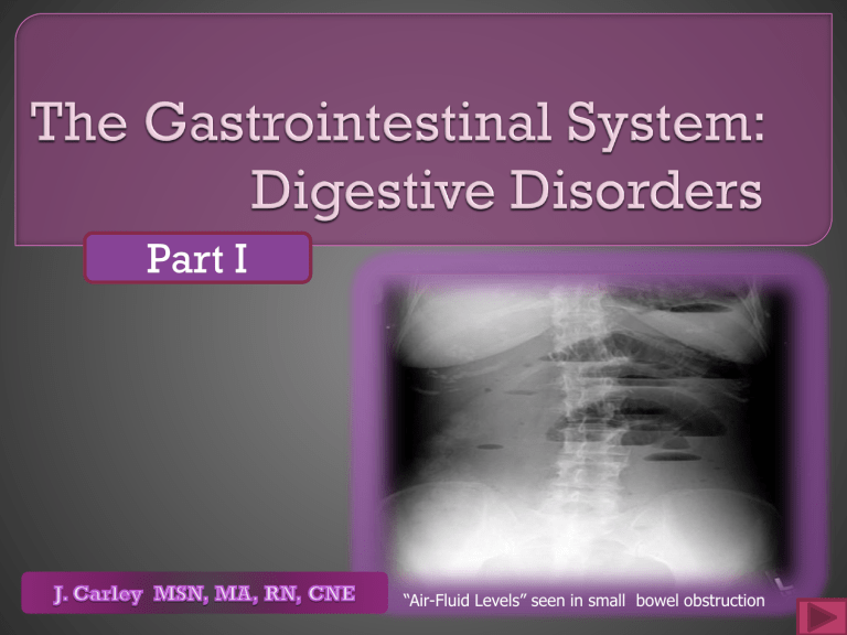 case study 44 gastrointestinal disorders