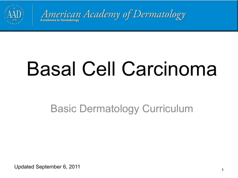 Basal Cell Carcinoma American Academy Of Dermatology
