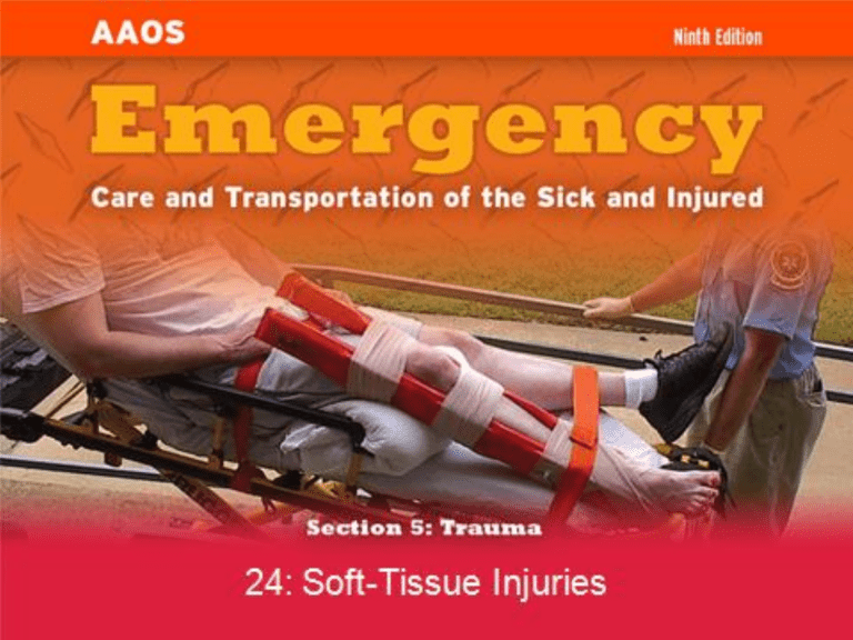 How Bad Is A Soft Tissue Injury