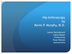 PowerPoint Presentation - Hip Arthroscopy by Kevin
