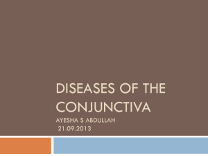 Diseases of the conjunctiva