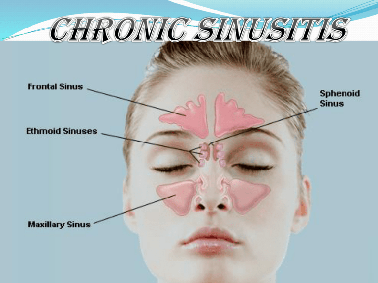 Chronic Sinusitis