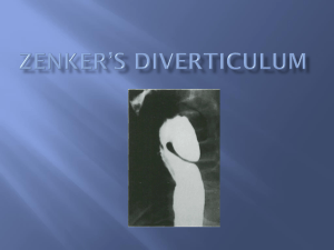 Zenker`s Diverticulum - the UNC Department of Medicine
