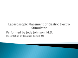 Laparoscopic Placement of Gastric Electro Stimulator