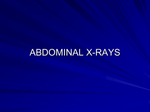 Abdominal X-Ray - Yale School of Medicine