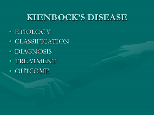 Keinboch`s Disease