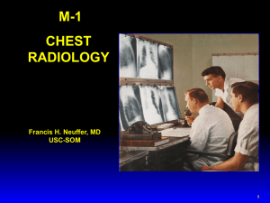 ct chest anatomy