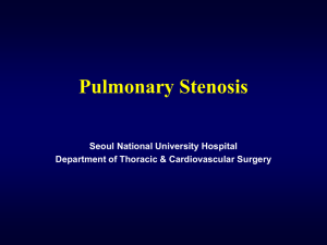 Pulmonary Stenosis and Intact Ventricular Septum