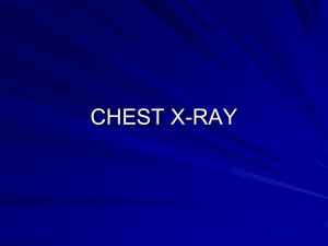 Chest X-Ray - Yale School of Medicine