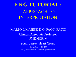 EKG TUTORIAL - South Jersey Heart Group