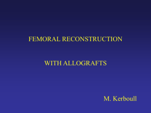 Femoral reconstruction with allografts