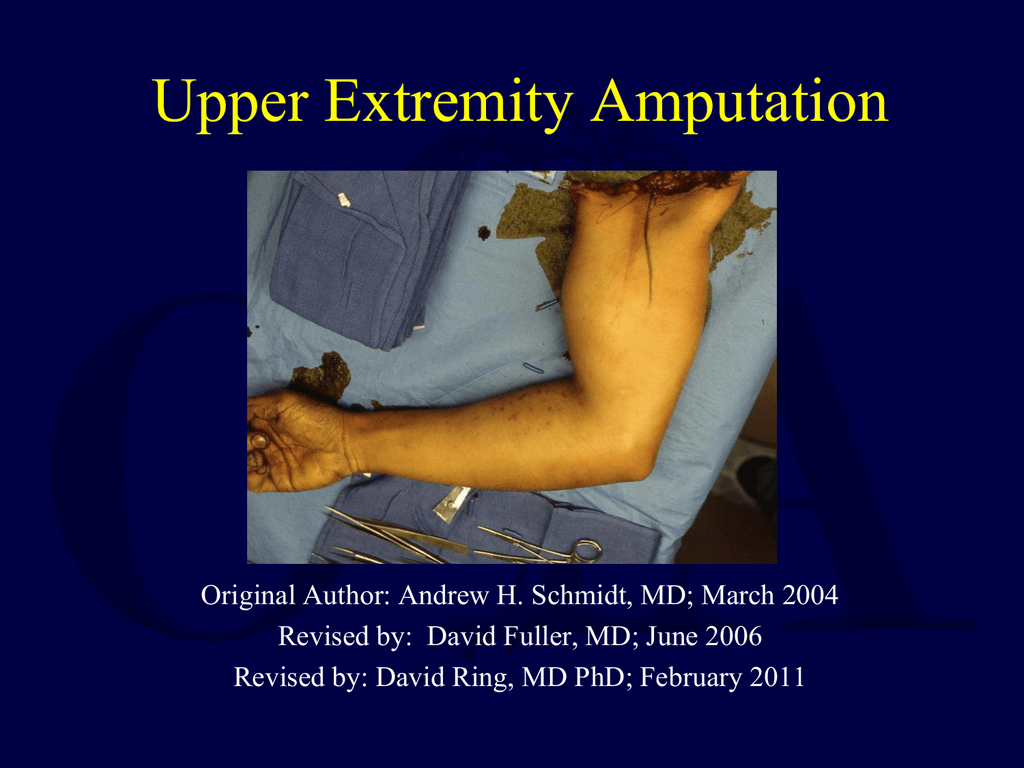 Upper Limb Amputee