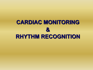 Cardic monitoring, rhythm recognition