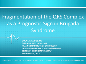 fragmentation of the qrs complex as a prognostic sign in brugada