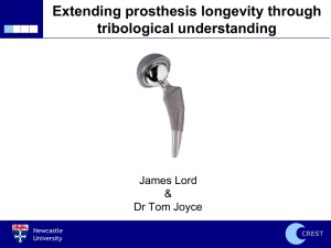 Analysis of failed metal-on-metal hip prostheses