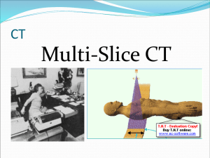 Multi-slice CT
