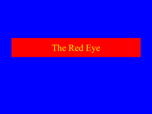 Red Eye Powerpoint