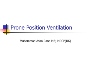 prone position ventilation