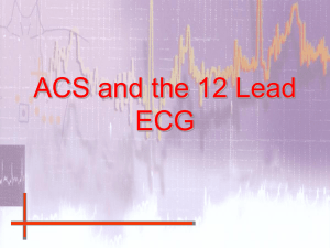 ACS and the 12 Lead ECG