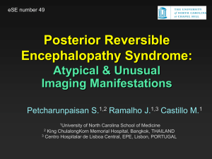 Posterior Reversible Encephalopathy Syndrome: Atypical
